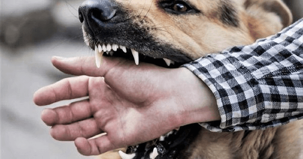 Напад собаки біля ліцею в Броварах